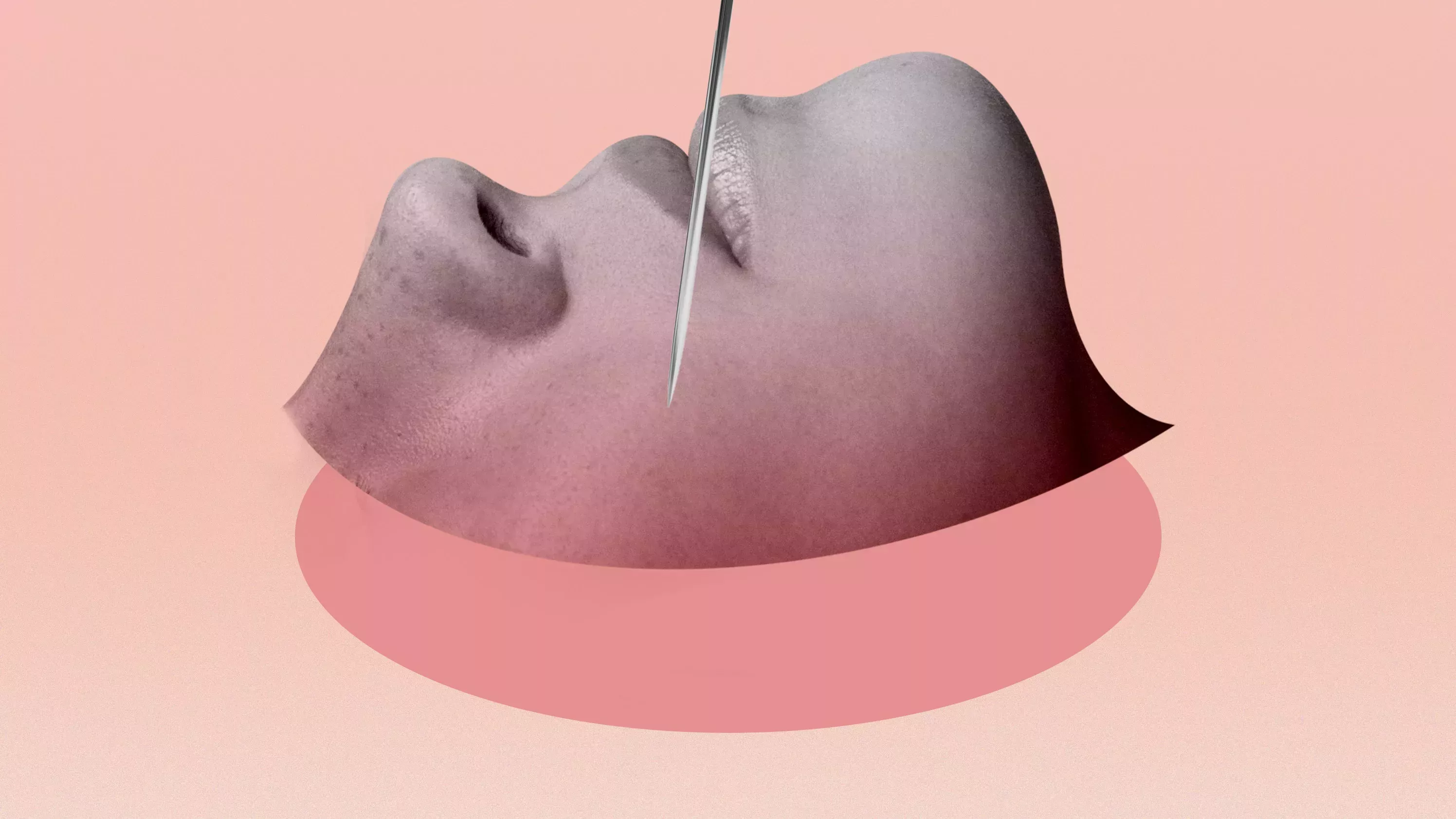 El microcorte es un tratamiento reafirmante que no requiere tiempo de inactividad