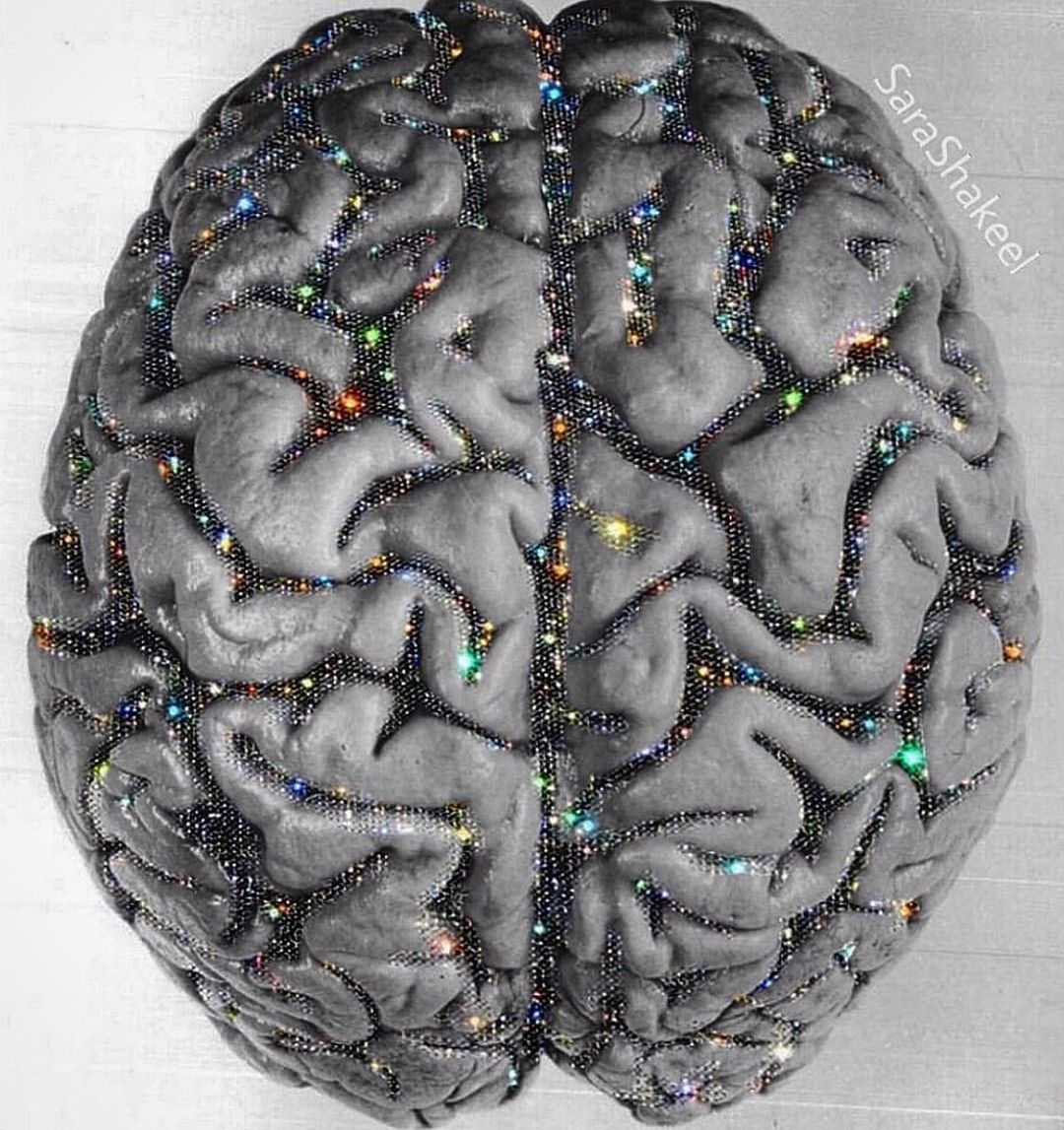 6 maneras de mantener sano el cerebro