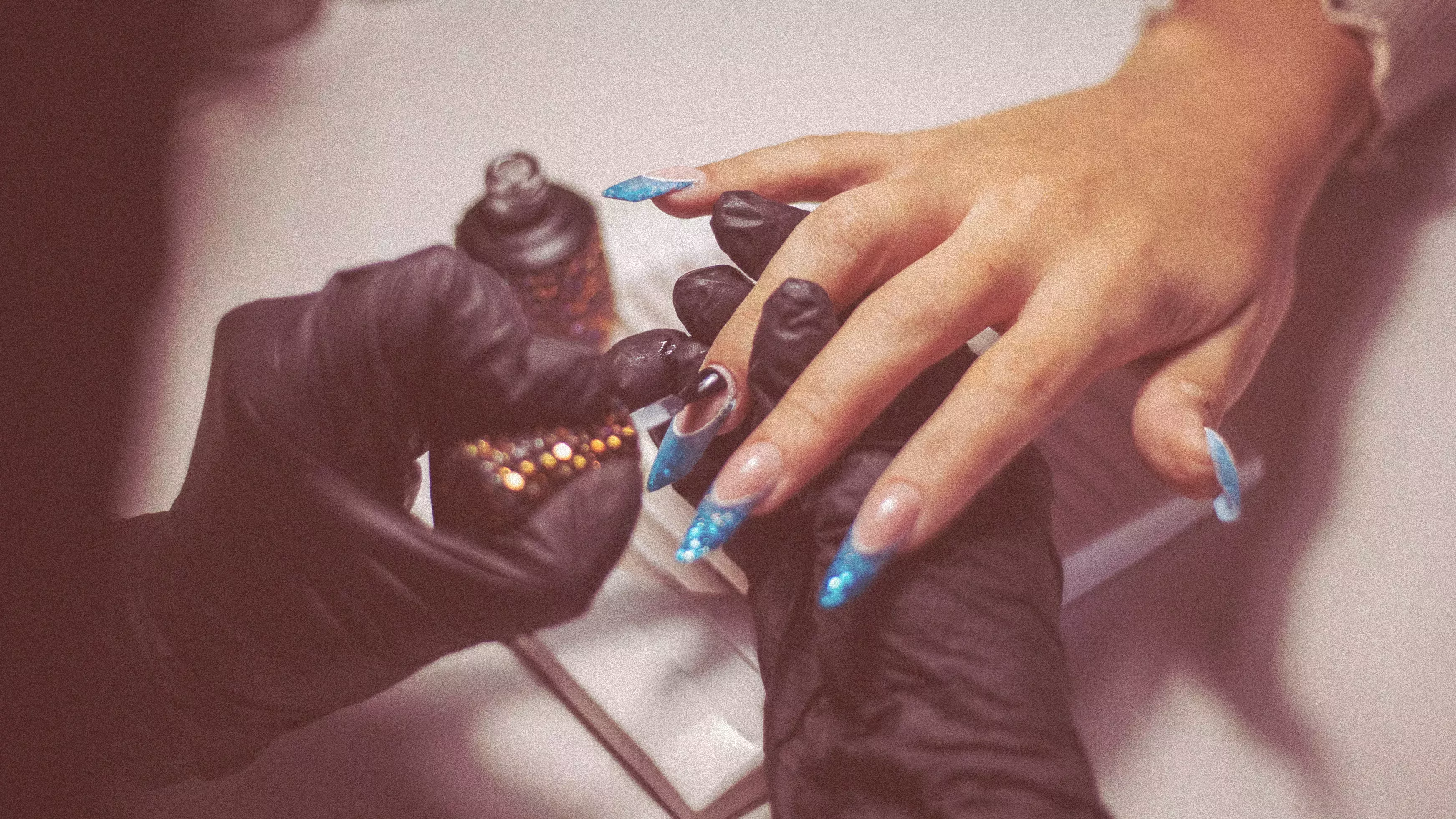 ¿Por qué tantas personas sufren alergia a las uñas de gel?