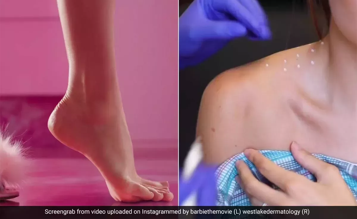 ¿Quieres un cuello como el de Barbie? Esta tendencia de belleza viral y más llevan la fiebre de Barbie adelante