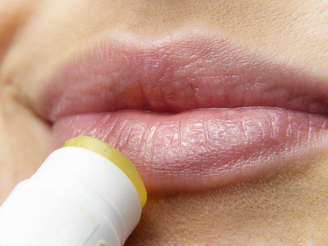 ¿Cómo curar el herpes labial rápido?