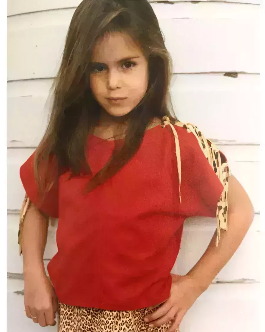 Sarah Howard&#8217;s Brow Transplant Journey