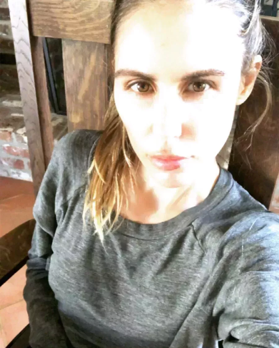 Sarah Howard&#8217;s Brow Transplant Journey-5