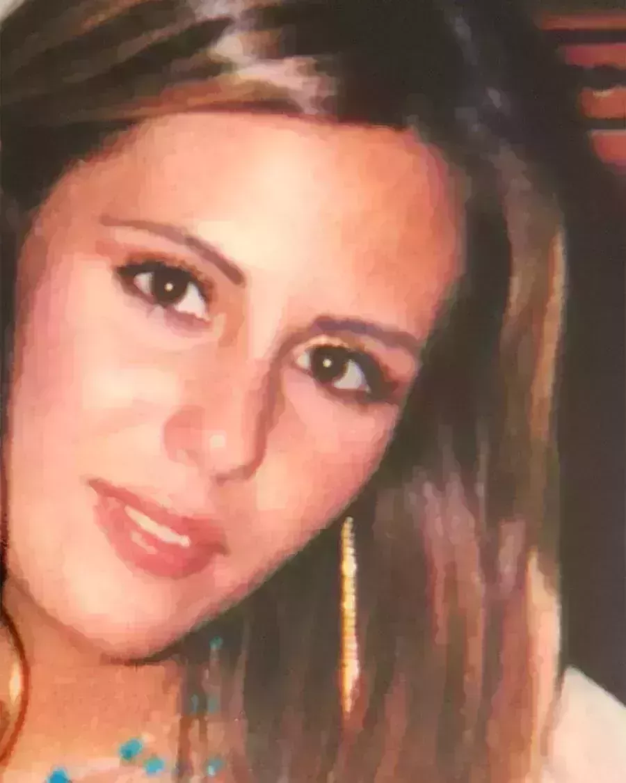 Sarah Howard&#8217;s Brow Transplant Journey-1