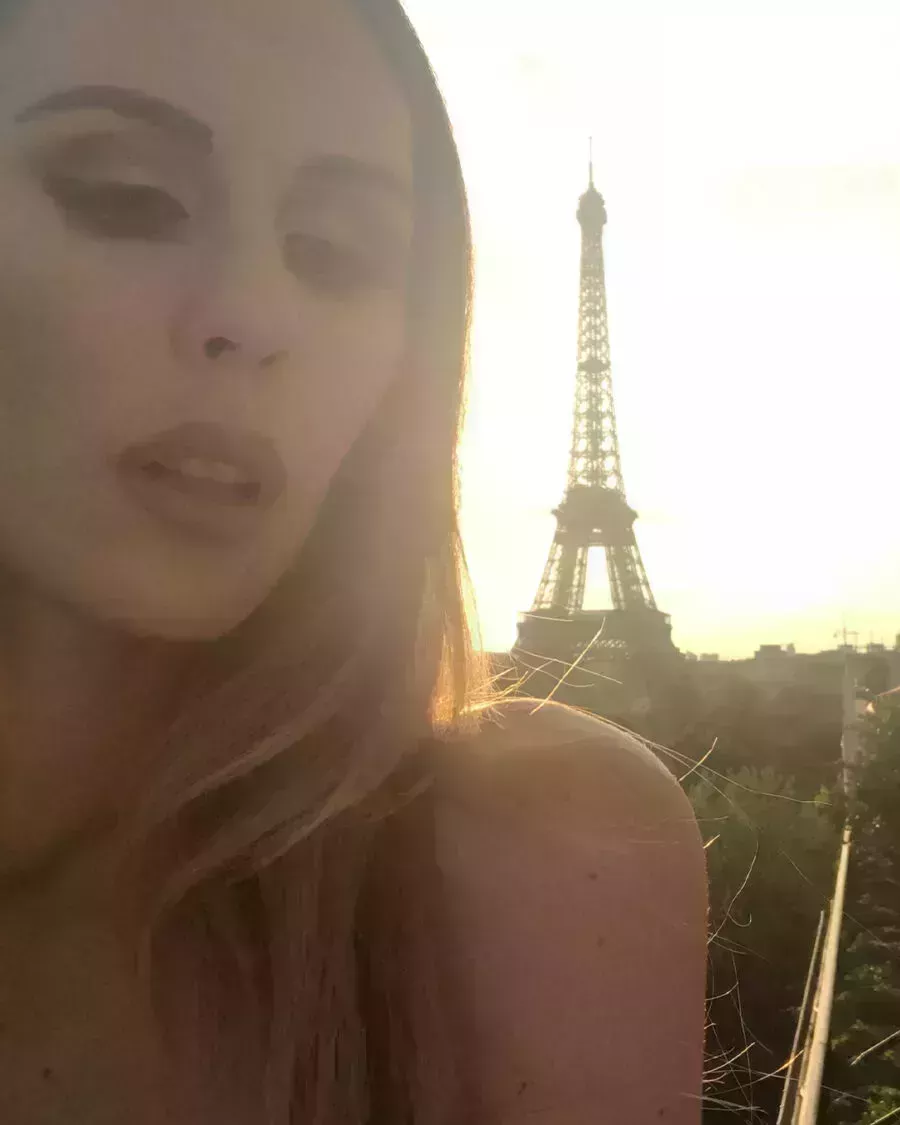 Sarah Howard&#8217;s Brow Transplant Journey