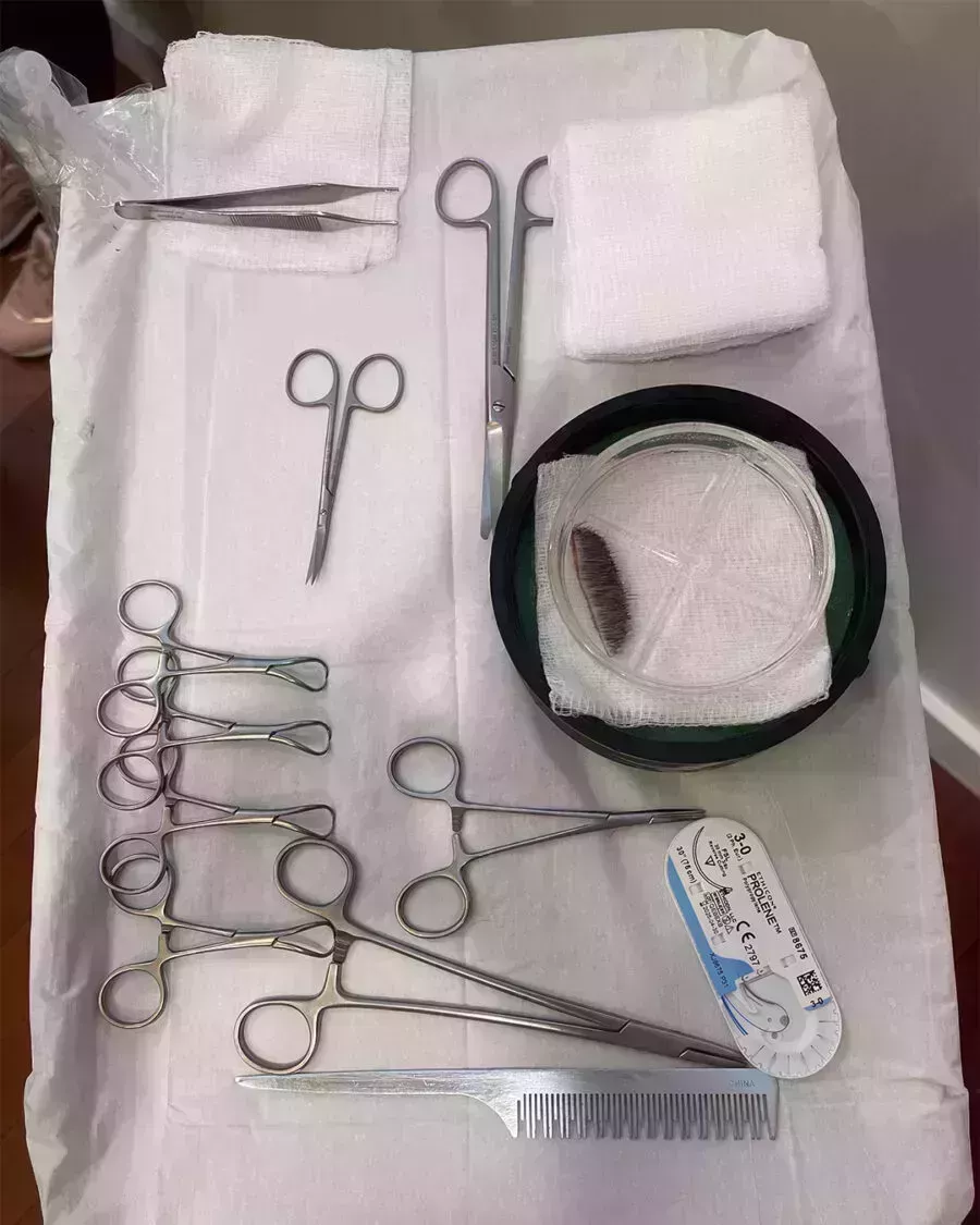 Sarah Howard&#8217;s Brow Transplant Journey-2