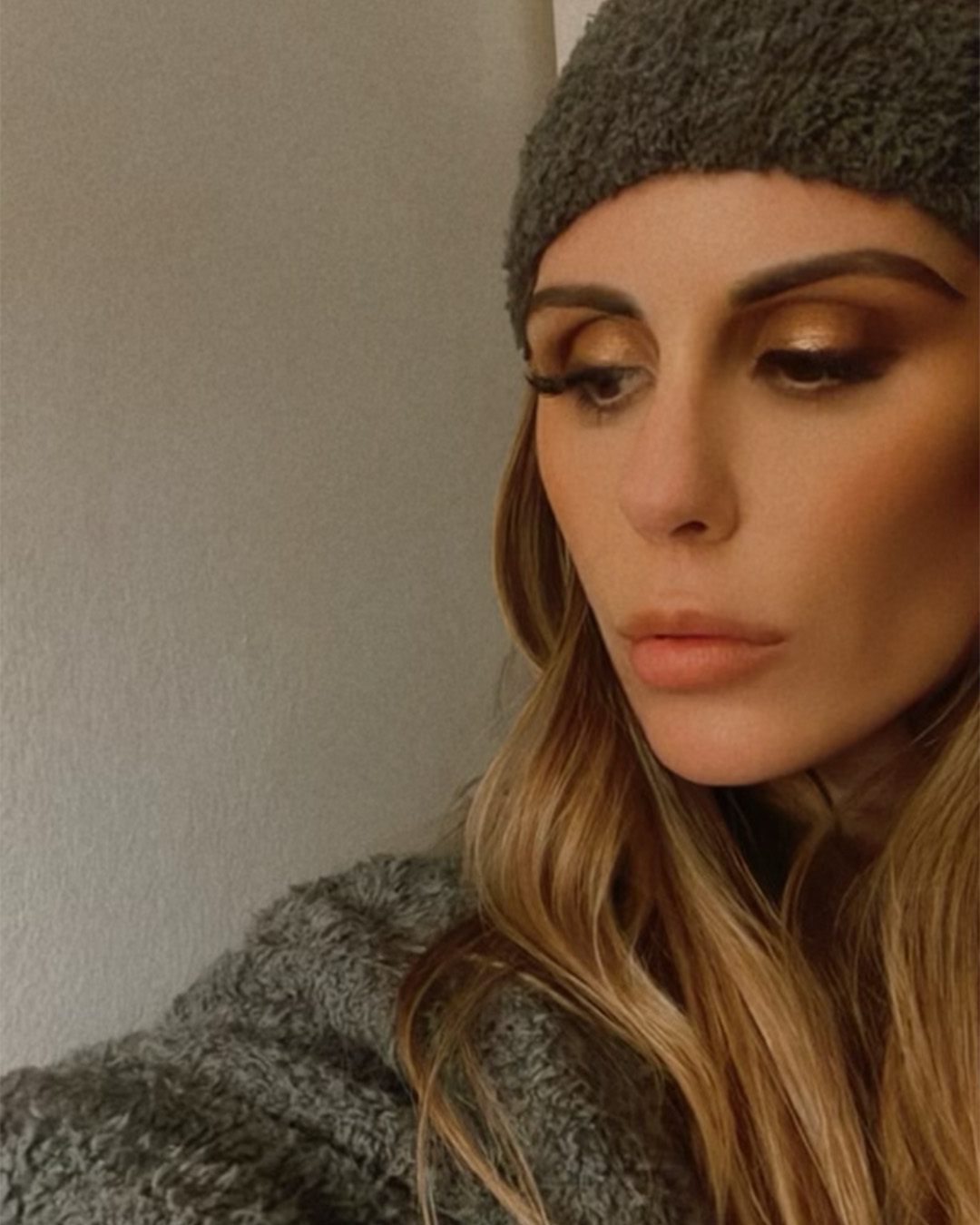 Me hice un trasplante de cejas y juro que mi cara parece más joven