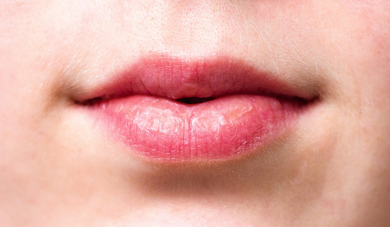 ¿Qué es lo mejor para los labios muy secos?