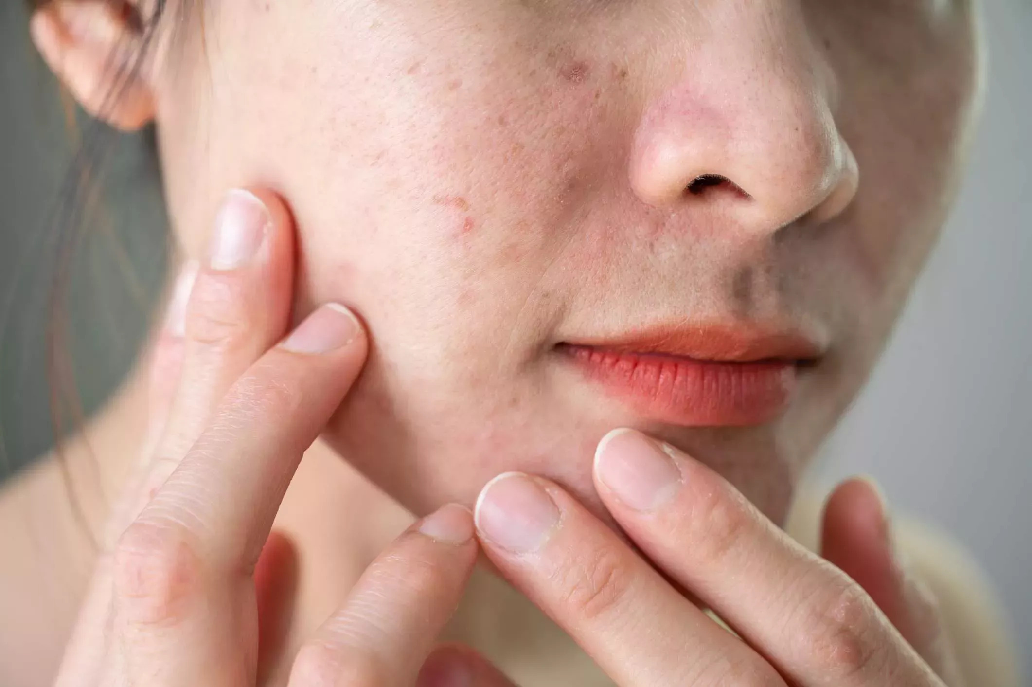 Así se mejora la textura de la piel, según los dermatólogos