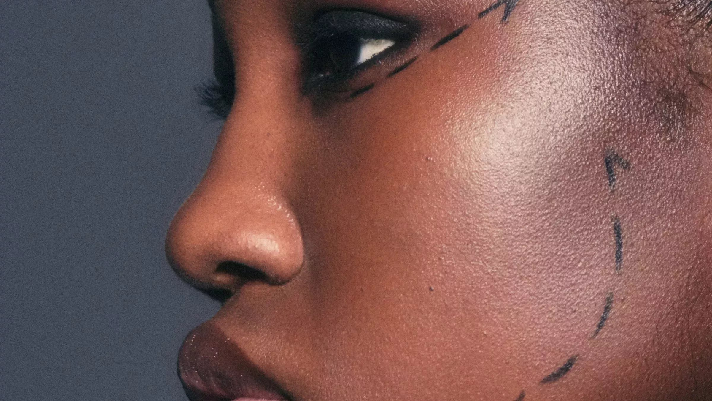 ¿Cuál es la edad ideal para un lifting facial?