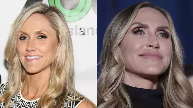 Dermatóloga estética nos cuenta los 4 procedimientos más obvios de Lara Trump