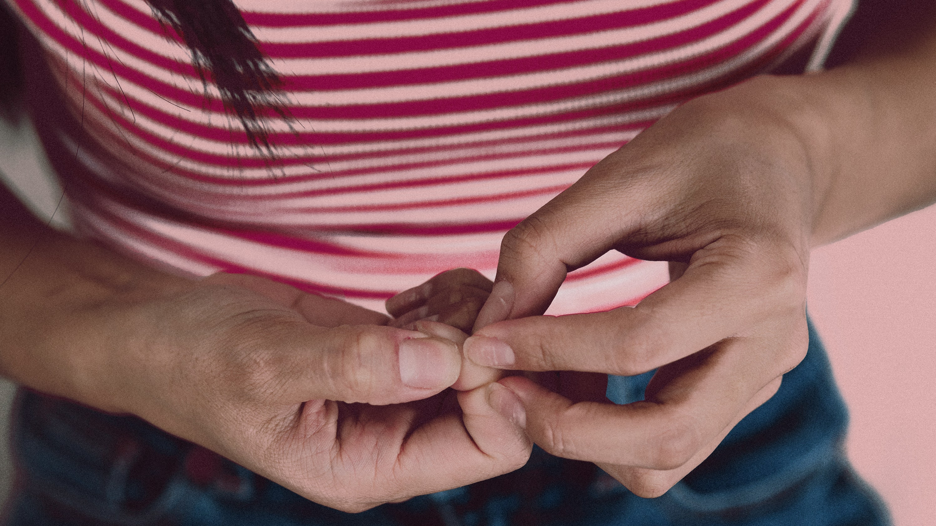 El poco conocido impacto de la psoriasis en las uñas