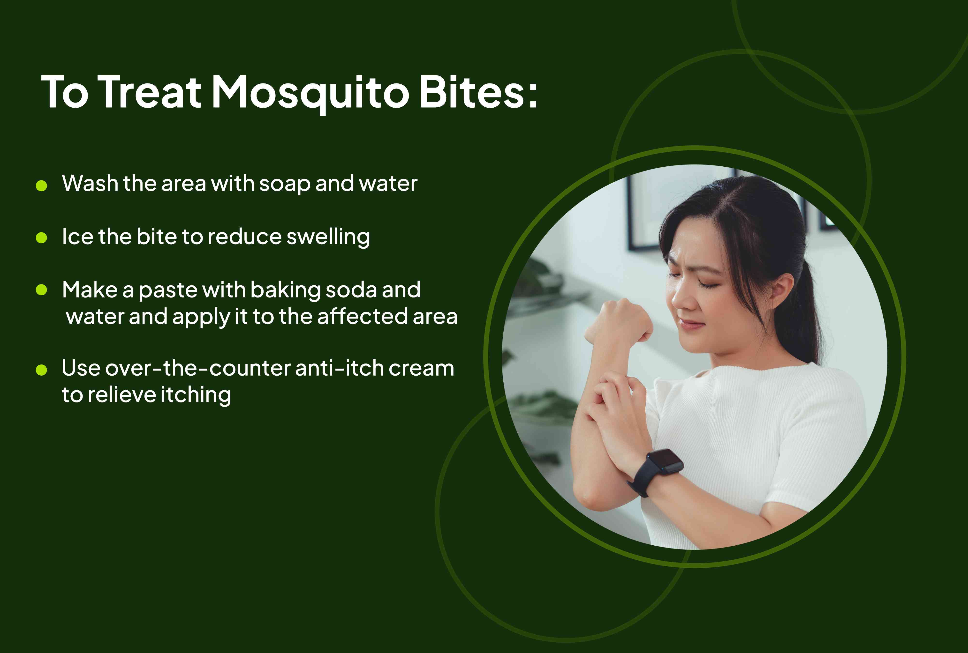 Lo que hay que saber sobre las picaduras de mosquito
