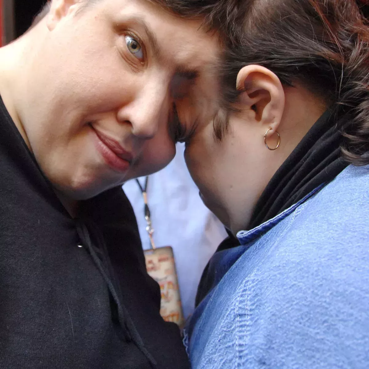 Lori y George Schappell, los gemelos unidos más ancianos del mundo, mueren a los 62 años