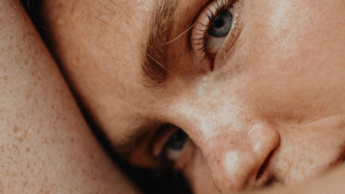 Me puse botox para tratar la depresión