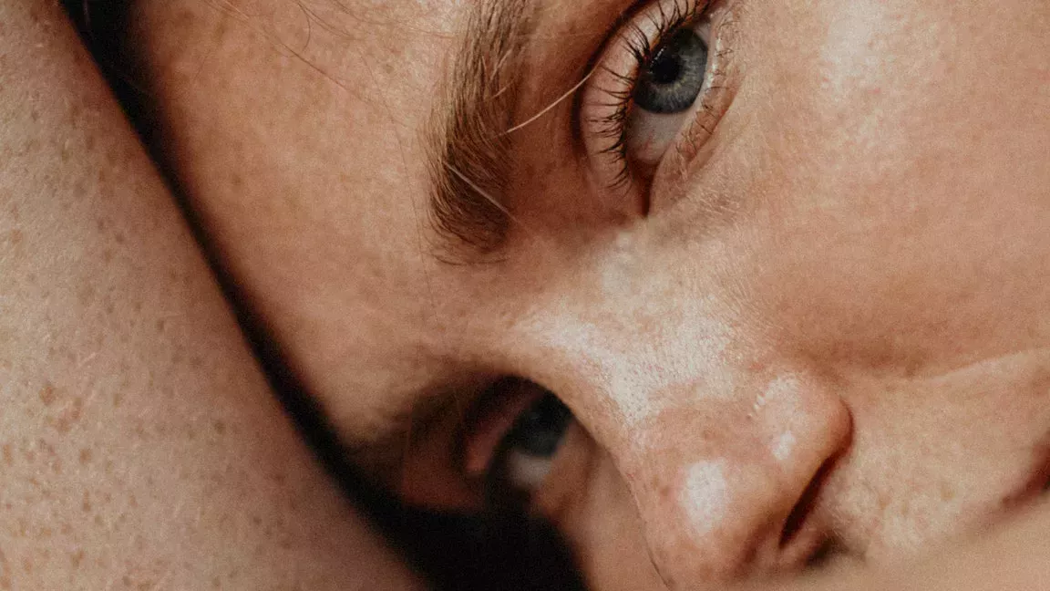 Me puse botox para tratar la depresión