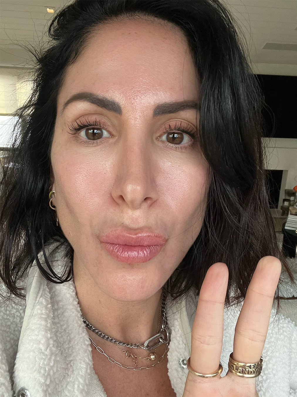 ¿Una ecografía para la cara?