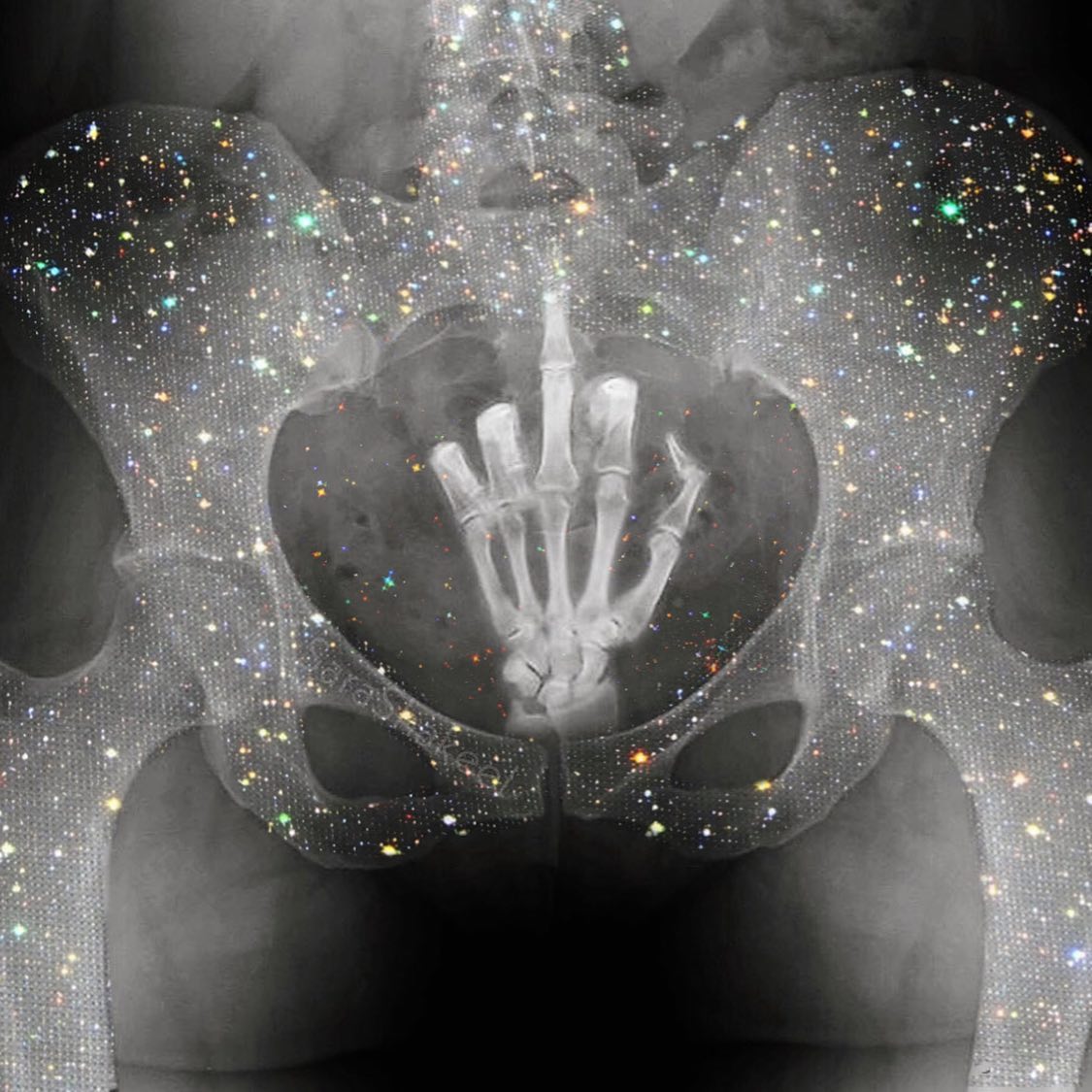 El síntoma menos conocido de la menopausia del que deberíamos hablar