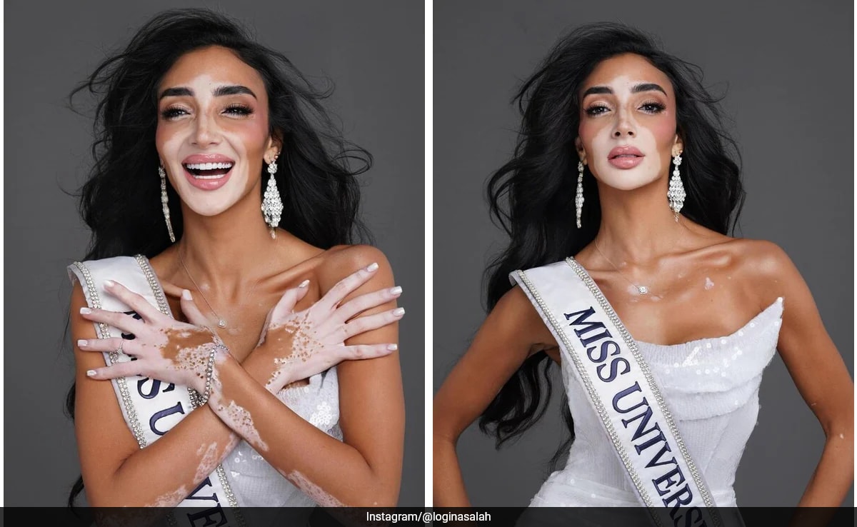 Logina Salah de Egipto conquista corazones como la primera concursante de Miss Universo con vitiligo