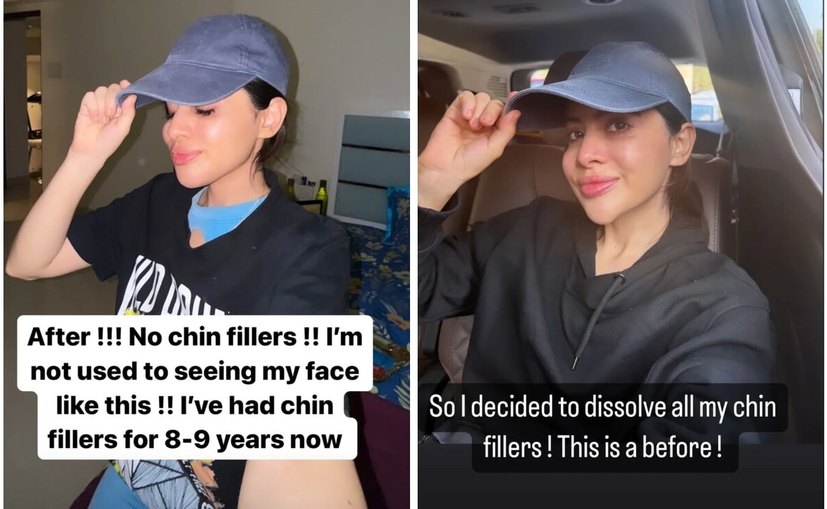 "No estoy acostumbrada a ver mi cara así", Uorfi Javed se disuelve los rellenos de mentón después de nueve años