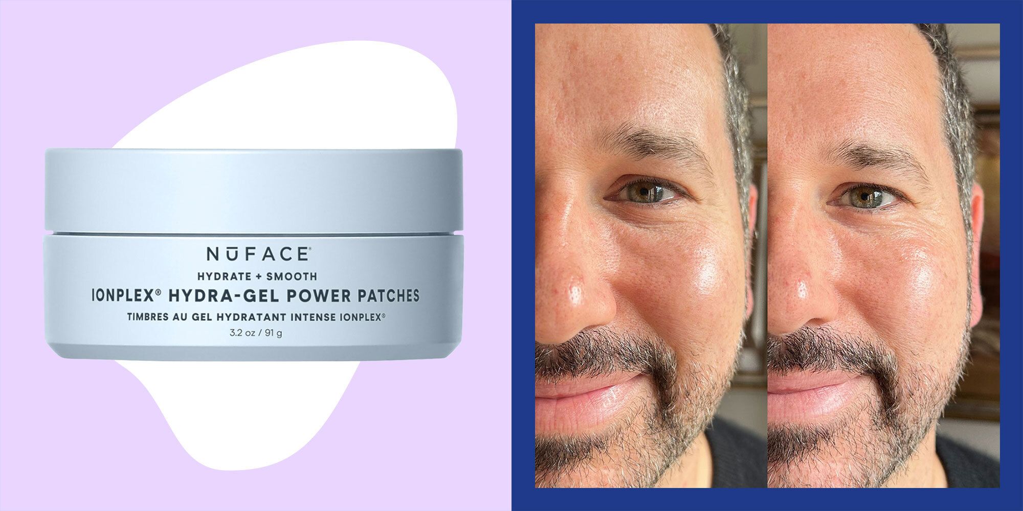 Estos parches para el área de los ojos suavizaron y iluminaron mis ojos en solo 5 minutos—Aquí está la prueba