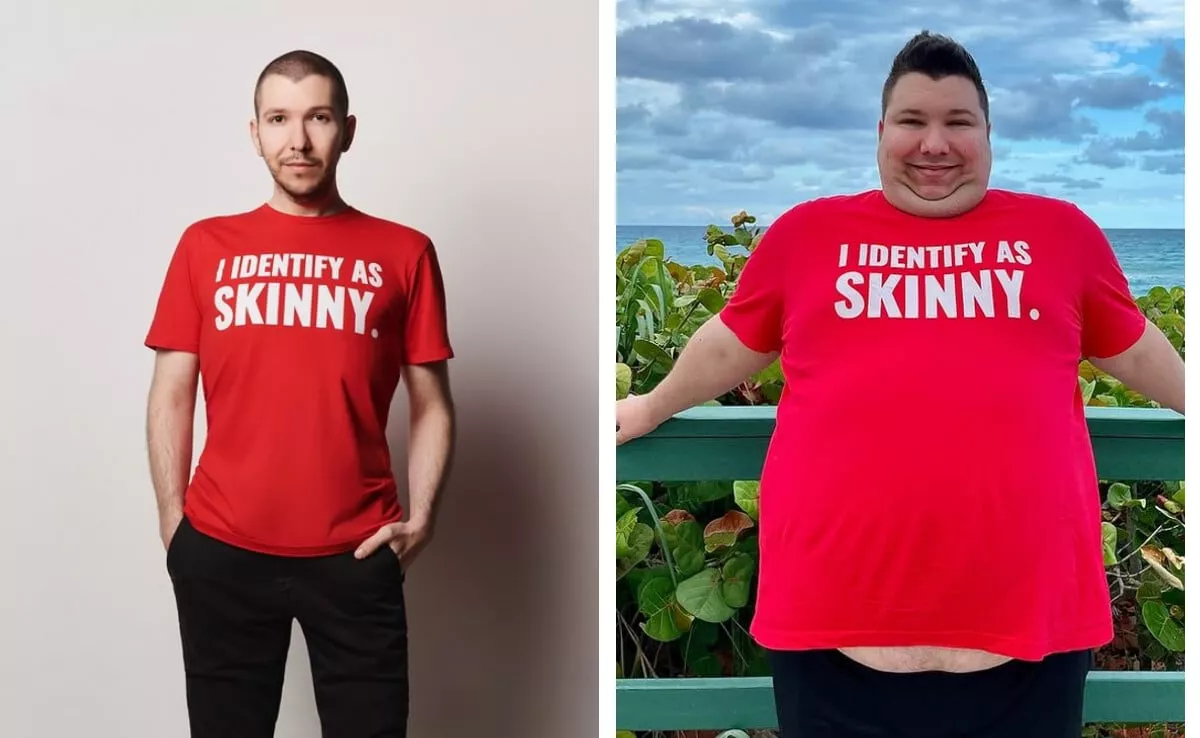 El Facelift Post-Pérdida de Peso del YouTuber Nikocado Avocado: 