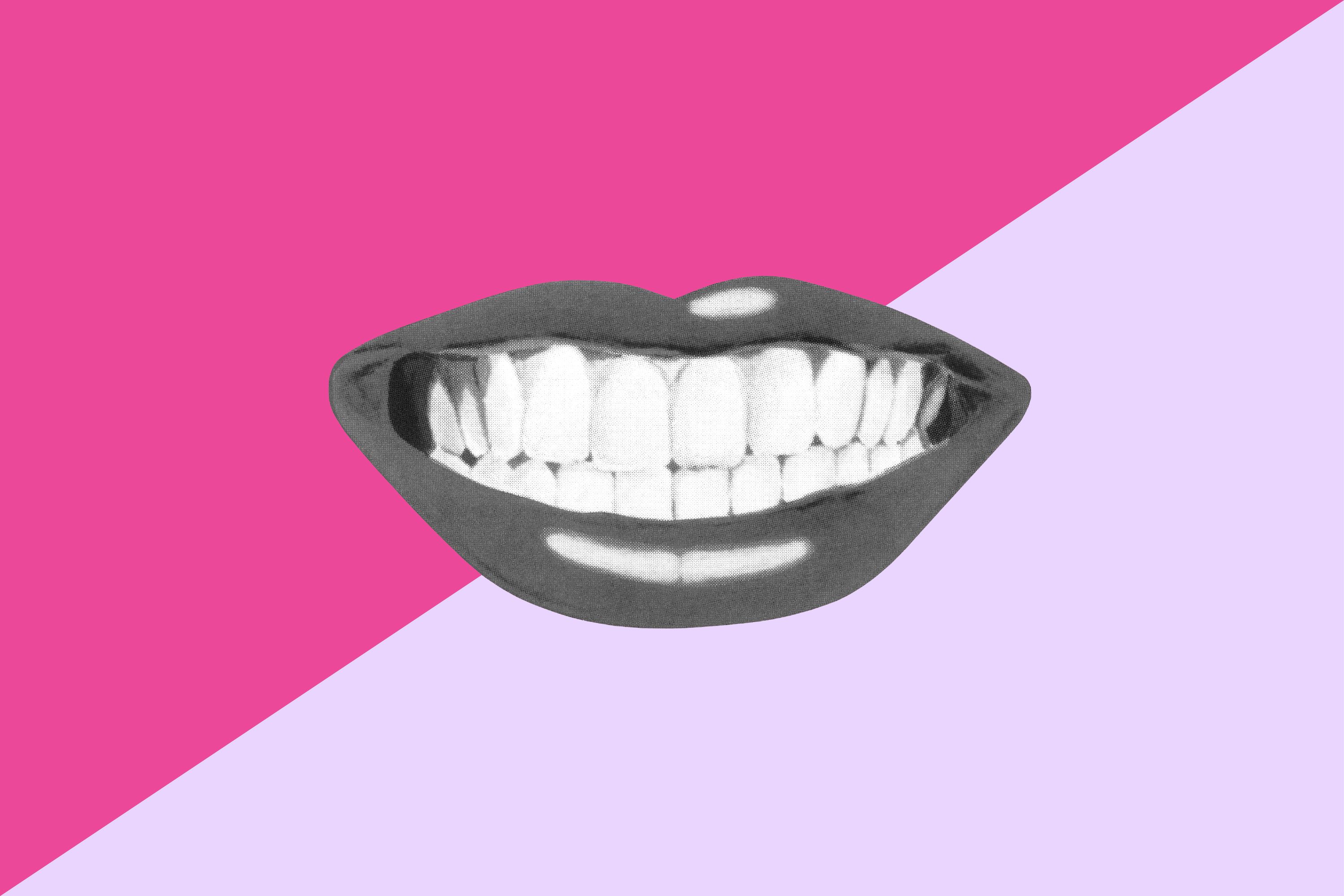 Las Carillas Mal Hechas Están en Todas las Redes Sociales: Lo Que los Dentistas Quieren Que Sepas Sobre Cómo Obtener la Sonrisa 'Perfecta'