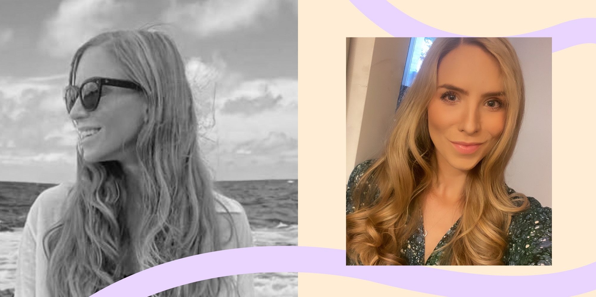 Mis luchas con esta condición de salud tuvieron un gran impacto en mi cabello. Aquí está lo que lo hizo crecer de nuevo.