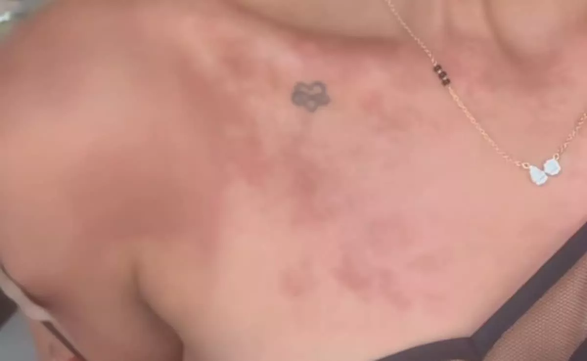 Consejos para Prevenir Alergias en la Piel por el Haldi Usado Durante Ceremonias de Bodas