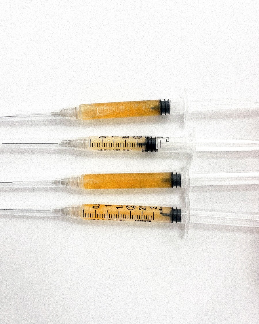 Probé un Facelift PRP