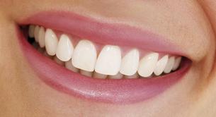 Las sonrisas perfectas ya no se llevan