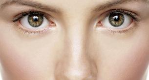 ¿Por qué tengo acné?