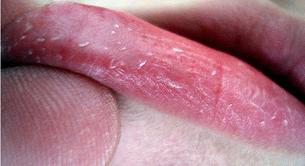 Cómo acabar de una vez por todas con los labios agrietados 