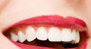 Dos trucos para conseguir lucir unos dientes más blancos en cuestión de minutos 