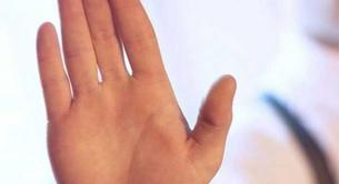 Operarse las líneas de la mano para cambiar el futuro 