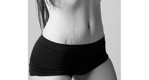 Cuerpos de madres reales en un libro, A Beautiful Body