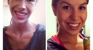 Fotos de cómo superar la anorexia