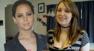 Se gasta 18.000 euros para parecerse a Jennifer Lawrence