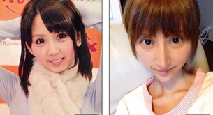 Una chica se opera tantas veces que termina pareciéndose al elfo de Harry Potter