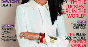 Turia Pitt, la mujer que posó con la cara quemada