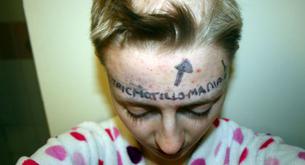 Se queda calva por un trastorno de ansiedad