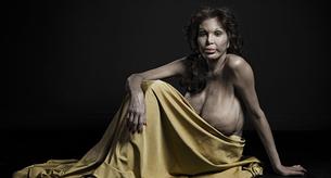 Polémicas fotos de personas desfiguradas por la cirugía estética