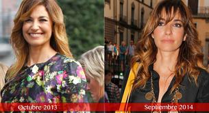 ¿Se ha operado Mariló Montero?