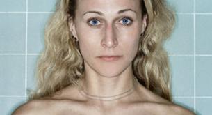 Las asombrosas fotografías que documentan el cáncer de mama