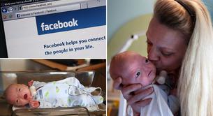 Facebook censura las fotos del bebé que nació sin nariz