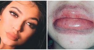 ¿Cuál es el secreto de los grandes labios de Kylie Jenner? Este, seguro que no