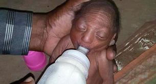 Se niega a cuidar a su bebé cuando ve que nace con una enfermedad