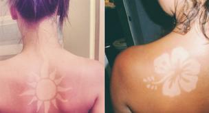 ¡Cuidado! La moda del 'Sunburnart' es peligrosa