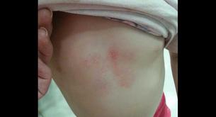 Una madre comparte las heridas de un bebé para dar una lección