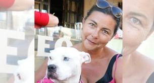 Encuentran en el ovario de una mujer el feto de su gemelo que nunca nació 